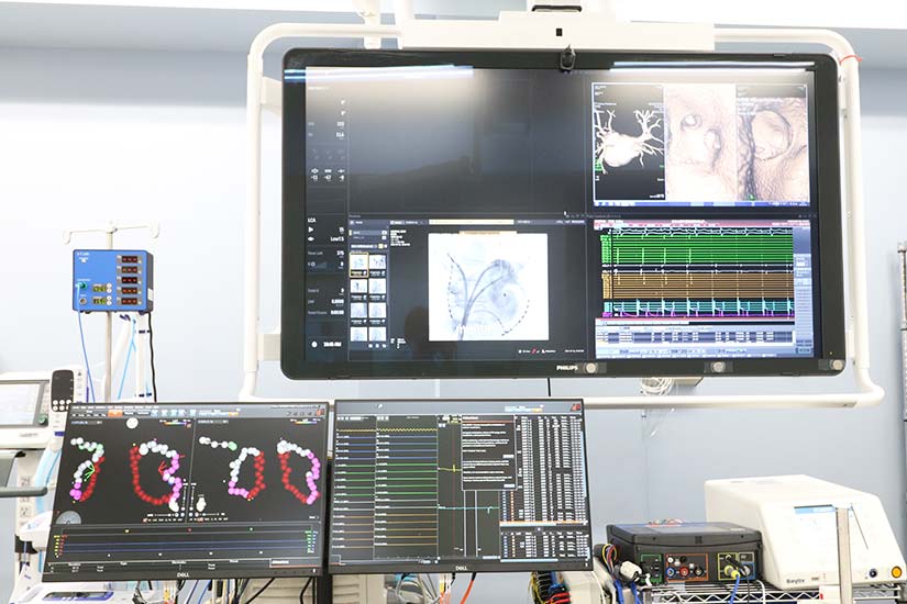 不整脈治療装置