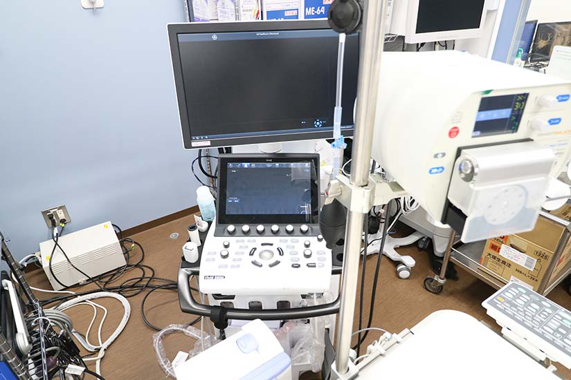 超音波診断装置