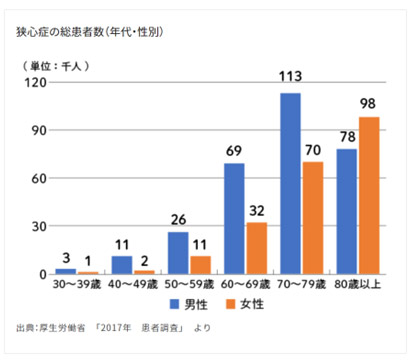 心臓ドックについて
