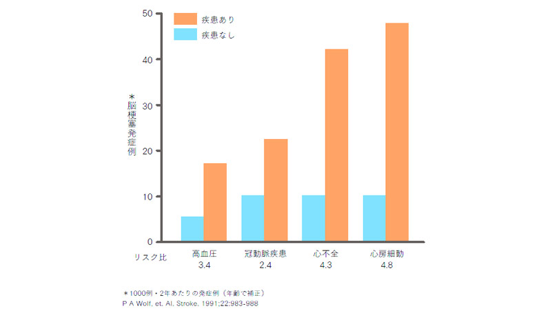 心房細動の脳卒中リスク