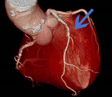 HITACHI社製0.4T　APERTO Inspire